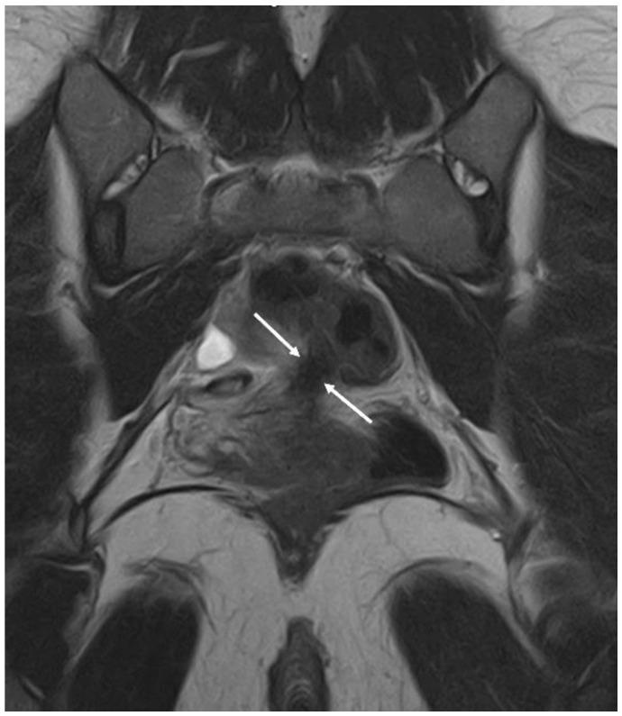 https://cdn.ncbi.nlm.nih.gov/pmc/blobs/c8b8/9777476/920bd354591b/diagnostics-12-02960-g008.jpg
