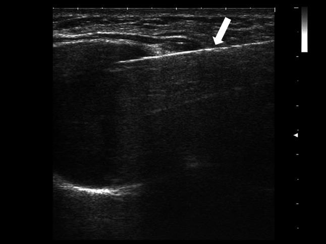 https://cdn.ncbi.nlm.nih.gov/pmc/blobs/c8bb/10063740/287ff2cb6fd8/40477_2022_773_Fig7_HTML.jpg
