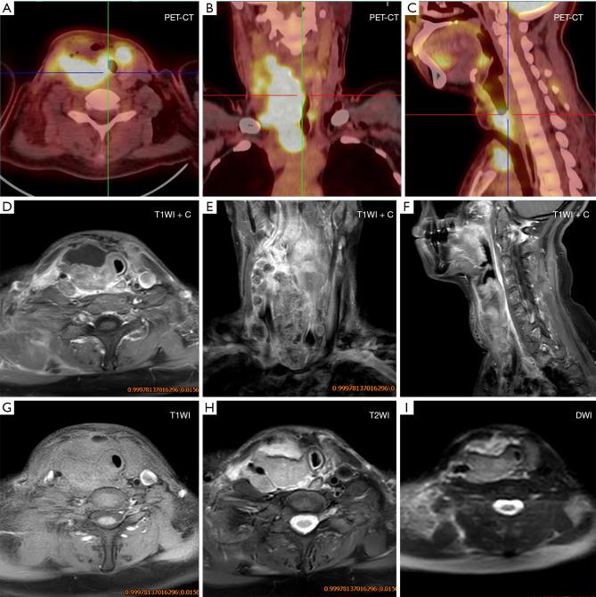 https://cdn.ncbi.nlm.nih.gov/pmc/blobs/c8be/11247582/6f647963885e/gs-13-06-1116-f4.jpg