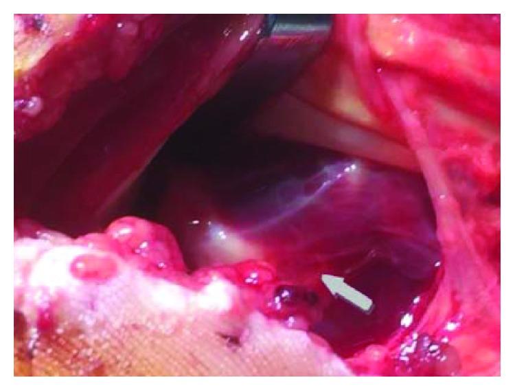 https://cdn.ncbi.nlm.nih.gov/pmc/blobs/c8be/6657645/5d628ce70628/CRIOR2019-7207856.003.jpg