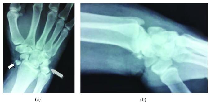 https://cdn.ncbi.nlm.nih.gov/pmc/blobs/c8be/6657645/fe7ff575bcaa/CRIOR2019-7207856.001.jpg
