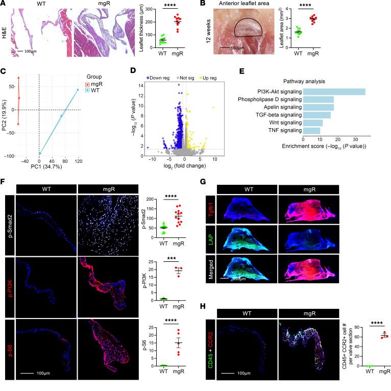 https://cdn.ncbi.nlm.nih.gov/pmc/blobs/c8bf/12259269/06e1bdc9a31d/jci-135-183558-g186.jpg