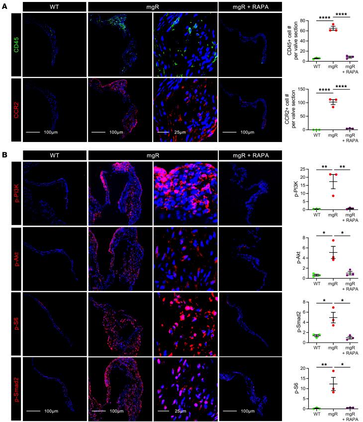 https://cdn.ncbi.nlm.nih.gov/pmc/blobs/c8bf/12259269/926600cb5f72/jci-135-183558-g190.jpg