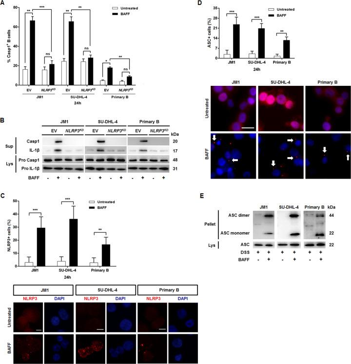 https://cdn.ncbi.nlm.nih.gov/pmc/blobs/c8d0/7529748/142c853f3ca6/41419_2020_3035_Fig3_HTML.jpg