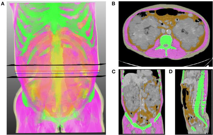 https://cdn.ncbi.nlm.nih.gov/pmc/blobs/c8da/8185023/d373717a8259/fmed-08-632097-g0001.jpg