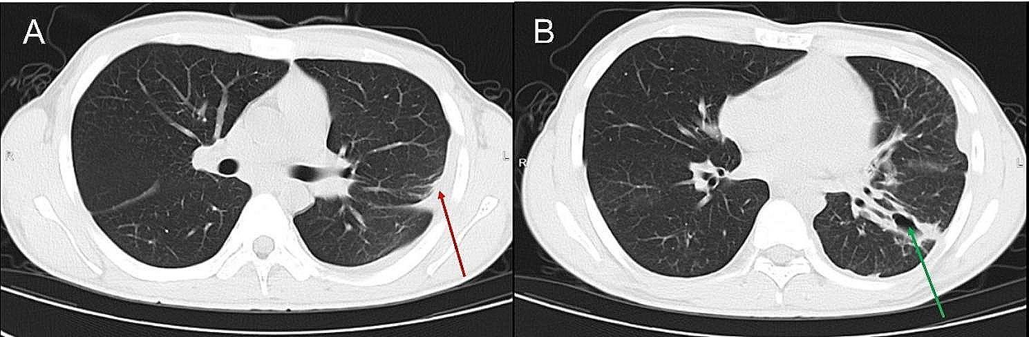 https://cdn.ncbi.nlm.nih.gov/pmc/blobs/c8dd/10875748/9319fb50554b/12879_2024_9087_Fig3_HTML.jpg