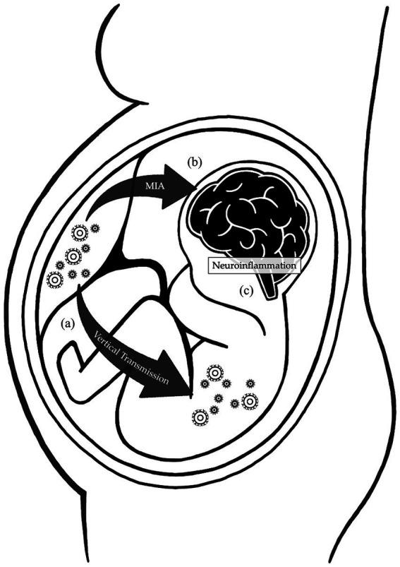https://cdn.ncbi.nlm.nih.gov/pmc/blobs/c8e3/10800711/797d4eb8b22f/fnins-17-1320319-g001.jpg