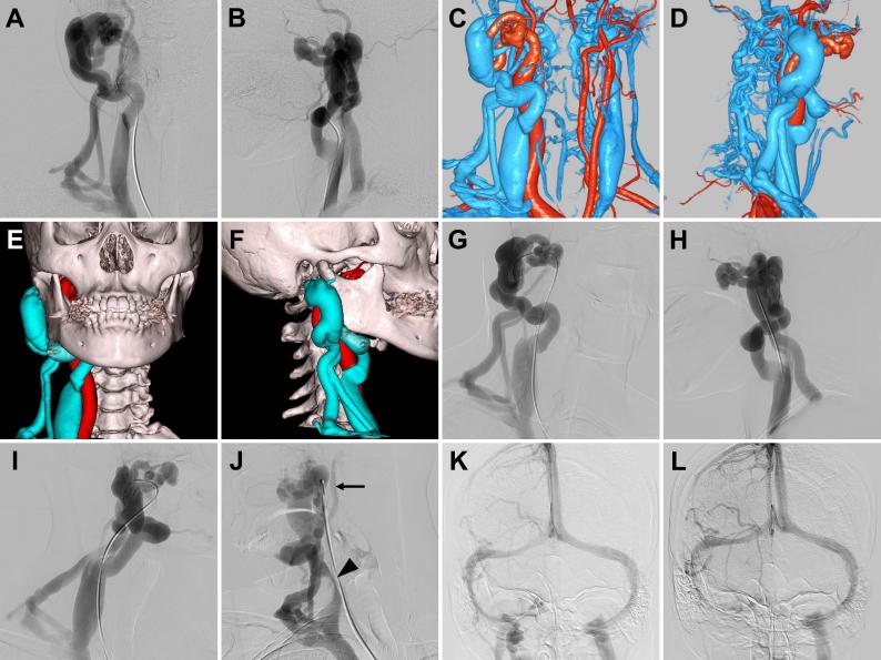 https://cdn.ncbi.nlm.nih.gov/pmc/blobs/c8e4/11579906/5413c9671cbf/CASE24407_figure_1.jpg