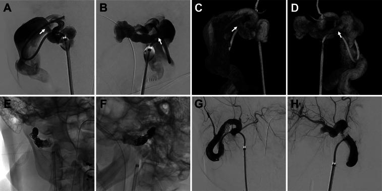 https://cdn.ncbi.nlm.nih.gov/pmc/blobs/c8e4/11579906/87fc8a886342/CASE24407_figure_3.jpg