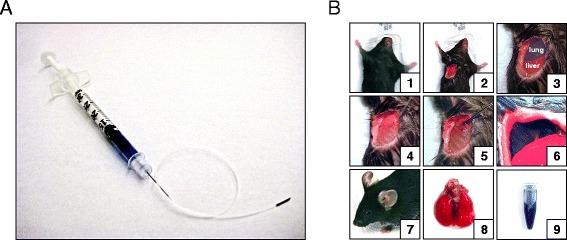 https://cdn.ncbi.nlm.nih.gov/pmc/blobs/c8e4/4336760/1273570e6421/12890_2015_10_Fig1_HTML.jpg