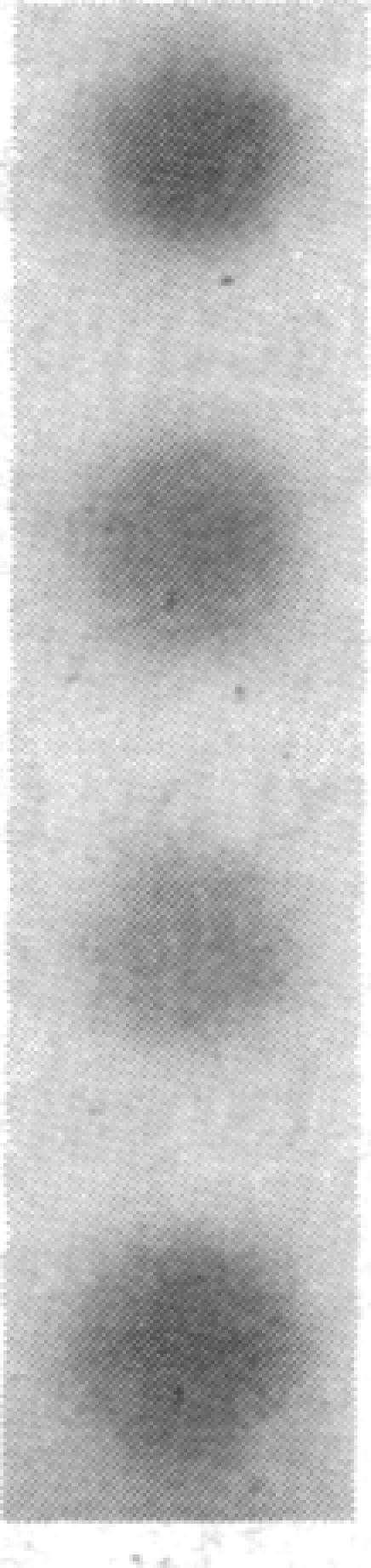 https://cdn.ncbi.nlm.nih.gov/pmc/blobs/c8e5/423994/7016053f2281/jcinvest00112-0107-d.jpg