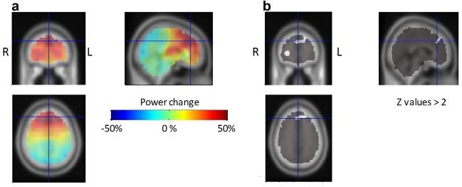 https://cdn.ncbi.nlm.nih.gov/pmc/blobs/c8e8/6869561/955dea149289/HBM-36-1866-g005.jpg