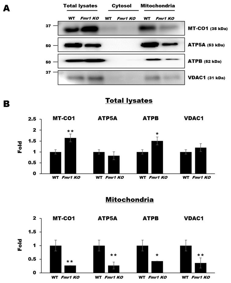 https://cdn.ncbi.nlm.nih.gov/pmc/blobs/c8f1/7794859/302a3cb6516b/ijms-22-00410-g004.jpg