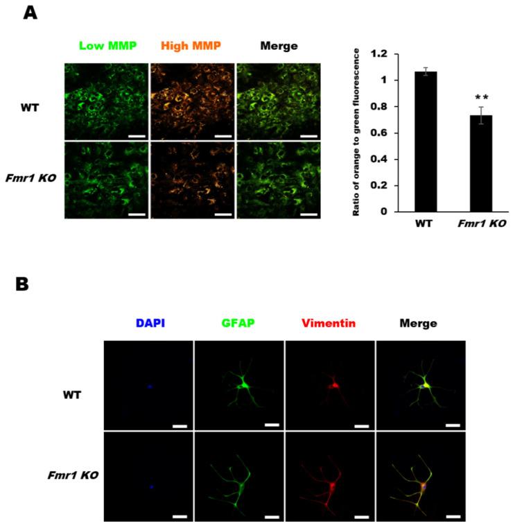 https://cdn.ncbi.nlm.nih.gov/pmc/blobs/c8f1/7794859/71c95621c6da/ijms-22-00410-g005.jpg