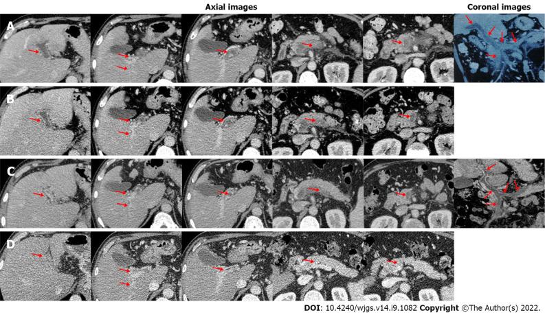 https://cdn.ncbi.nlm.nih.gov/pmc/blobs/c8f1/9521475/4ab70b1b1e6f/WJGS-14-1082-g001.jpg