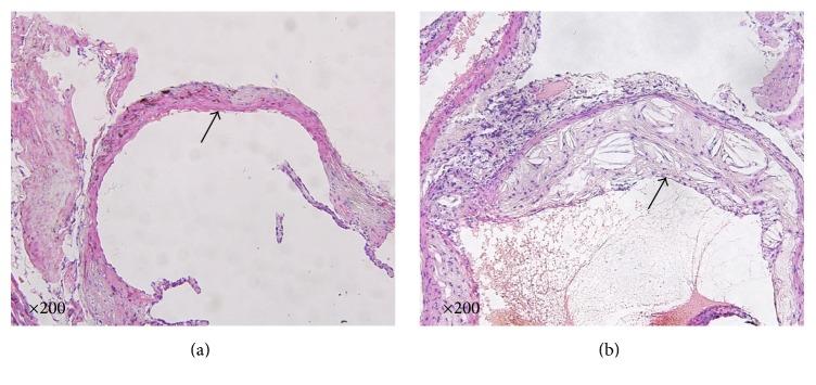 https://cdn.ncbi.nlm.nih.gov/pmc/blobs/c8f8/5405370/65b664d58f1a/ECAM2017-3121989.001.jpg