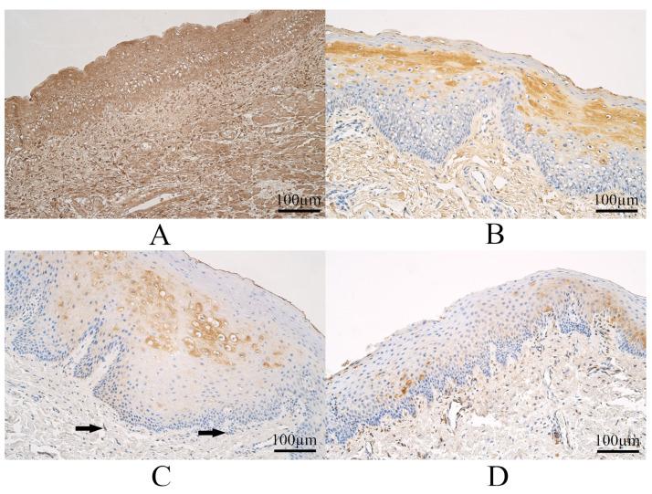 https://cdn.ncbi.nlm.nih.gov/pmc/blobs/c8f9/10297181/1351916cfc0d/dentistry-11-00151-g002.jpg