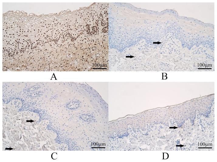 https://cdn.ncbi.nlm.nih.gov/pmc/blobs/c8f9/10297181/8b377df87c33/dentistry-11-00151-g003.jpg