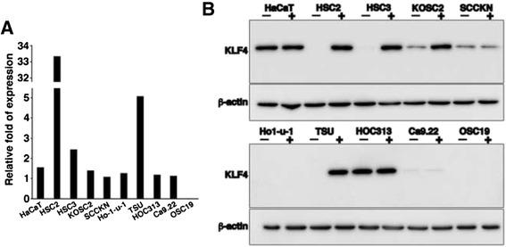 https://cdn.ncbi.nlm.nih.gov/pmc/blobs/c8f9/4743192/ecba244a5a1c/12903_2016_172_Fig4_HTML.jpg