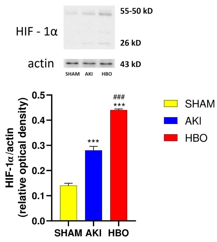 https://cdn.ncbi.nlm.nih.gov/pmc/blobs/c8fb/11011961/f4d2a32d5b2e/ijms-25-03870-g008.jpg