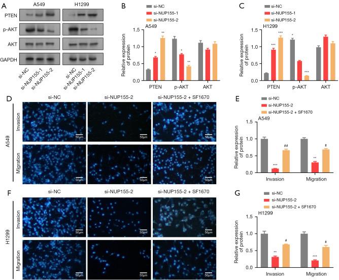 https://cdn.ncbi.nlm.nih.gov/pmc/blobs/c8fb/11651763/2f66cc934c2e/tcr-13-11-6323-f5.jpg