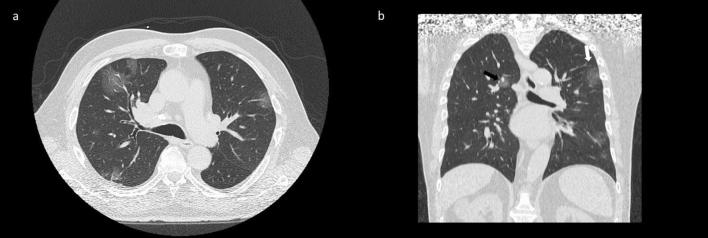 https://cdn.ncbi.nlm.nih.gov/pmc/blobs/c8fb/7566610/a669b95e31a3/41598_2020_73788_Fig4_HTML.jpg