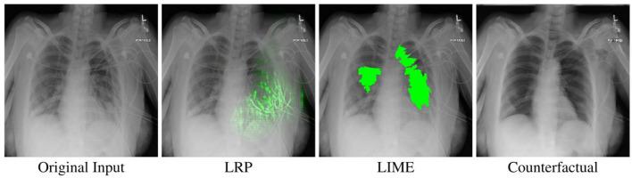 https://cdn.ncbi.nlm.nih.gov/pmc/blobs/c8fb/9024220/6a1cd4806196/frai-05-825565-g0005.jpg