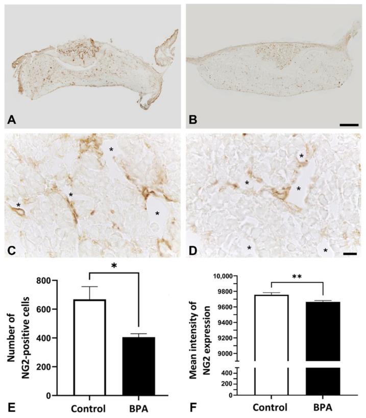 https://cdn.ncbi.nlm.nih.gov/pmc/blobs/c903/8657948/429d0441a9be/ijms-22-12667-g001.jpg