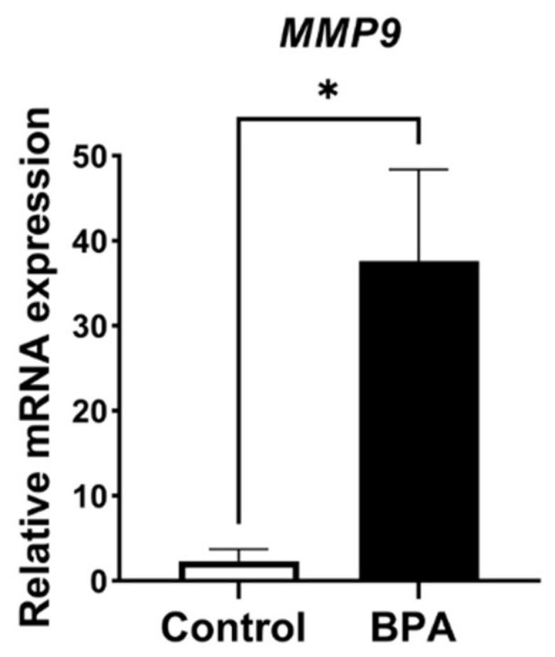 https://cdn.ncbi.nlm.nih.gov/pmc/blobs/c903/8657948/627dd029ff11/ijms-22-12667-g006.jpg