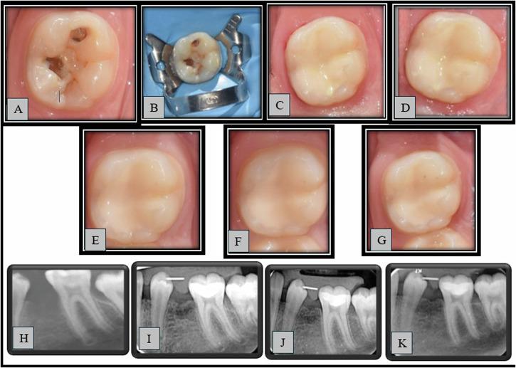 https://cdn.ncbi.nlm.nih.gov/pmc/blobs/c905/11718176/5b1116288ee0/41405_2024_286_Fig4_HTML.jpg