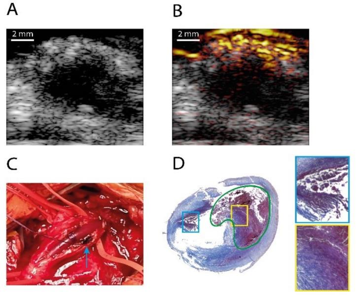 https://cdn.ncbi.nlm.nih.gov/pmc/blobs/c905/8659598/0e712b562d0a/sensors-21-07947-g009.jpg