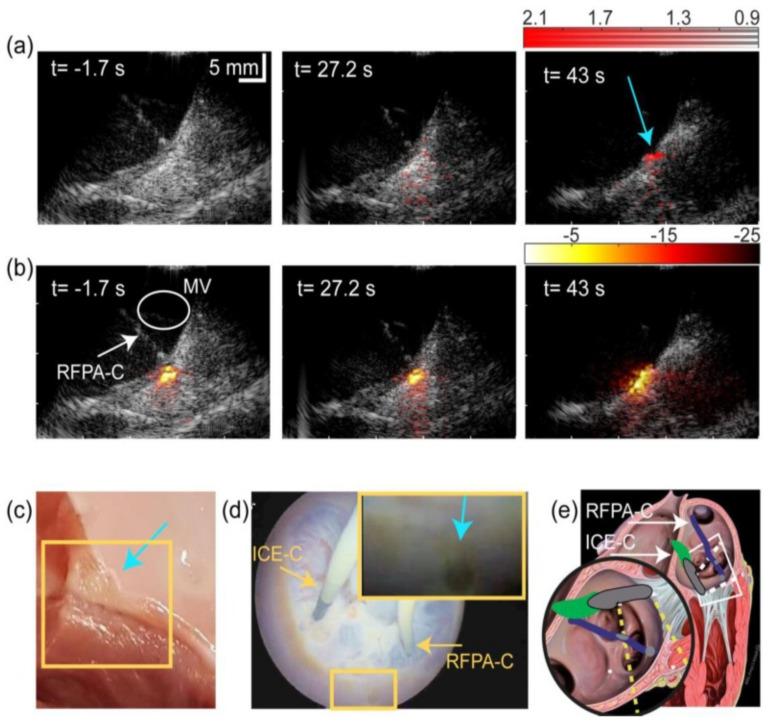 https://cdn.ncbi.nlm.nih.gov/pmc/blobs/c905/8659598/b40151a41d14/sensors-21-07947-g012.jpg