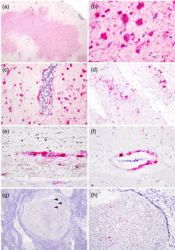 https://cdn.ncbi.nlm.nih.gov/pmc/blobs/c908/11529892/506621c8ae52/jgv-105-02035-g004.jpg