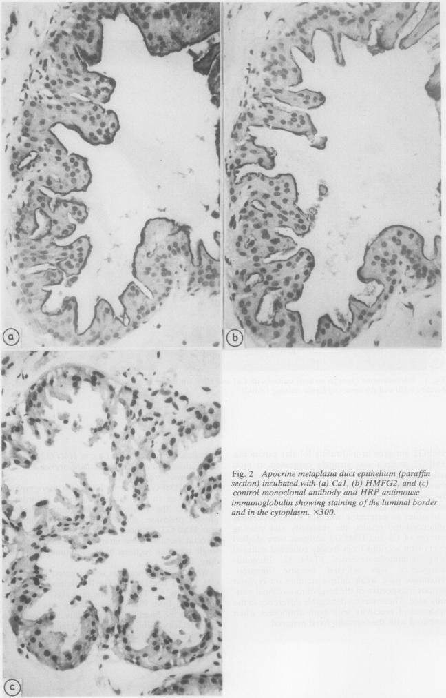 https://cdn.ncbi.nlm.nih.gov/pmc/blobs/c909/499200/47e0b93ea6a4/jclinpath00188-0036-a.jpg