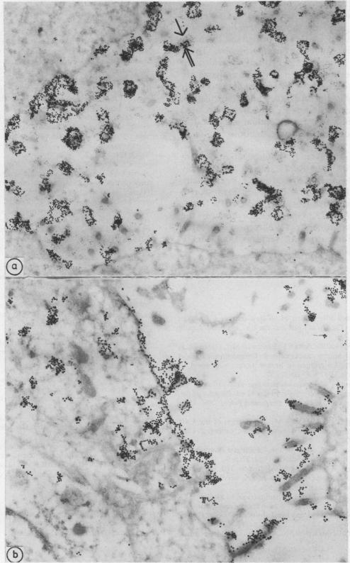 https://cdn.ncbi.nlm.nih.gov/pmc/blobs/c909/499200/af9051cb0aec/jclinpath00188-0039-a.jpg