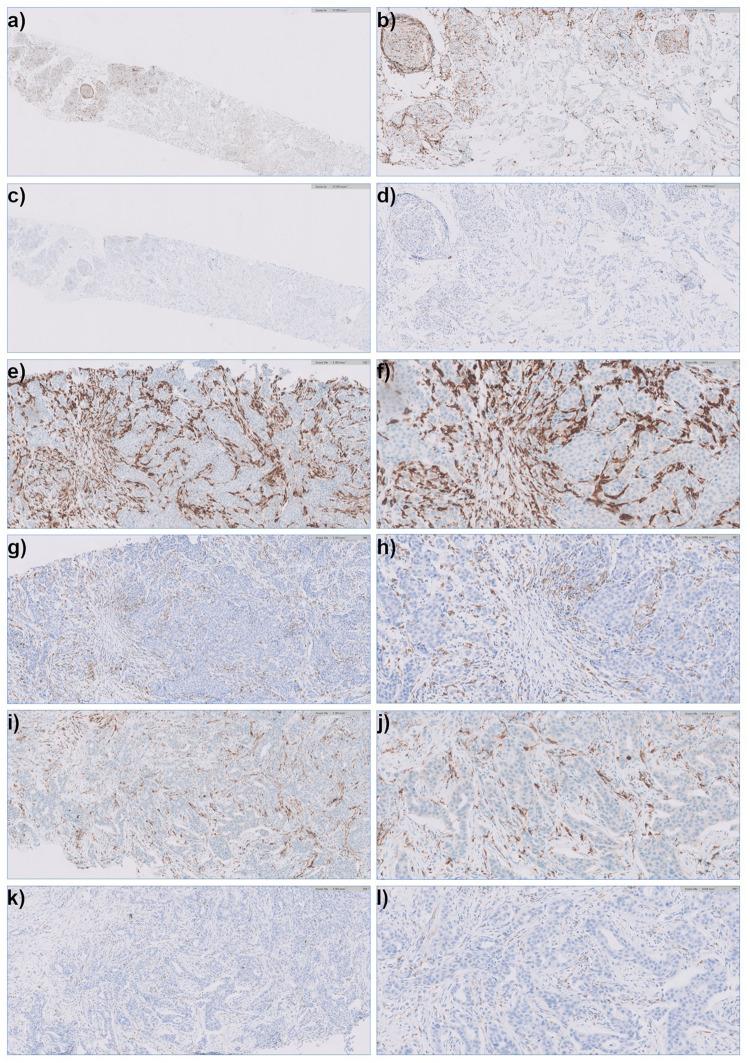 https://cdn.ncbi.nlm.nih.gov/pmc/blobs/c90b/11853881/b042ee14d6dc/BCTT-17-211-g0001.jpg