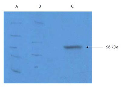https://cdn.ncbi.nlm.nih.gov/pmc/blobs/c90c/5487502/2e1ad6f21f55/WJG-23-4390-g001.jpg
