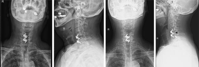 https://cdn.ncbi.nlm.nih.gov/pmc/blobs/c911/12091234/03b52428e98c/ORR-17-213-g0001.jpg