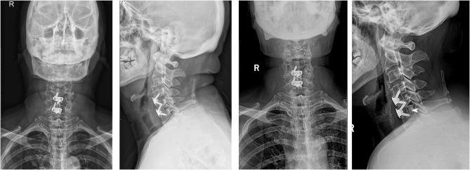 https://cdn.ncbi.nlm.nih.gov/pmc/blobs/c911/12091234/dbb6a7d82522/ORR-17-213-g0002.jpg