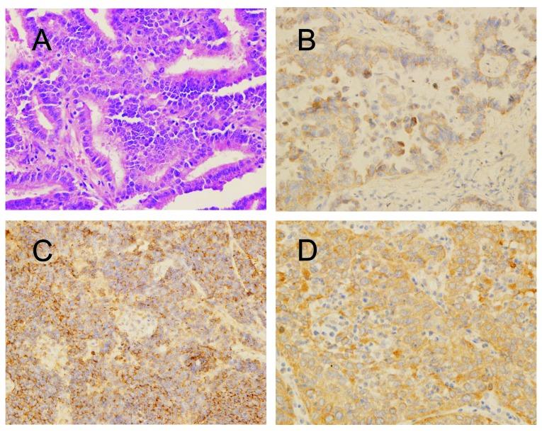 https://cdn.ncbi.nlm.nih.gov/pmc/blobs/c915/3583617/5c0d9b2b95d1/IJO-42-01-0093-g11.jpg