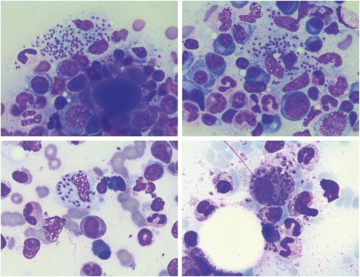 https://cdn.ncbi.nlm.nih.gov/pmc/blobs/c915/9914078/00e0eba93aea/CCR3-11-e6940-g001.jpg