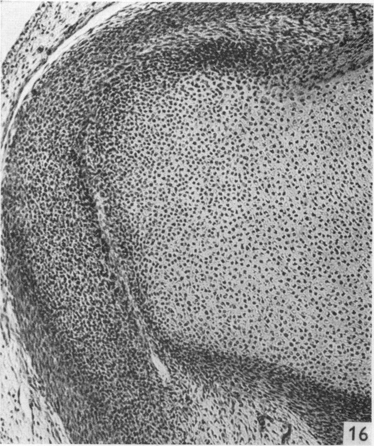https://cdn.ncbi.nlm.nih.gov/pmc/blobs/c91d/1231316/175d4b375e71/janat00406-0128-d.jpg