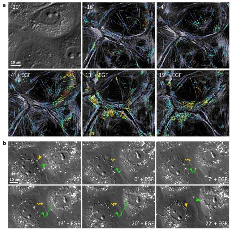 https://cdn.ncbi.nlm.nih.gov/pmc/blobs/c923/7140442/4cdd084891c5/cells-09-00578-g005.jpg