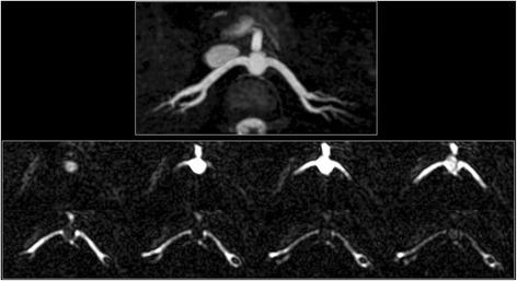 https://cdn.ncbi.nlm.nih.gov/pmc/blobs/c926/5819298/edd600a4de4e/12968_2018_433_Fig5_HTML.jpg