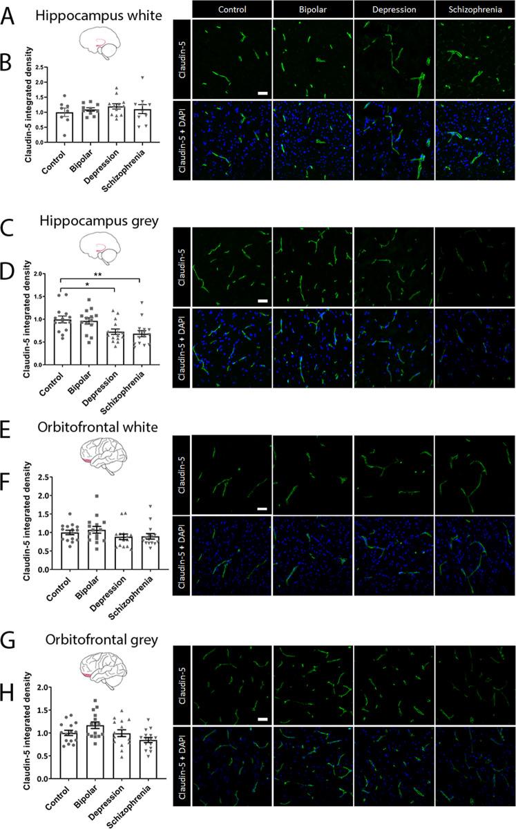 https://cdn.ncbi.nlm.nih.gov/pmc/blobs/c92e/7606459/dba52084863c/41398_2020_1054_Fig4_HTML.jpg