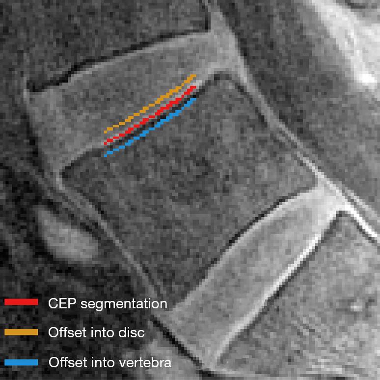 https://cdn.ncbi.nlm.nih.gov/pmc/blobs/c931/10167428/2a038fde1d92/qims-13-05-2807-f3.jpg
