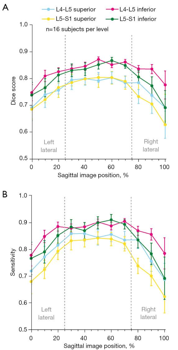 https://cdn.ncbi.nlm.nih.gov/pmc/blobs/c931/10167428/75468b6a8927/qims-13-05-2807-f5.jpg