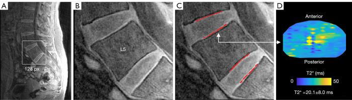 https://cdn.ncbi.nlm.nih.gov/pmc/blobs/c931/10167428/7c5ce7dcfba7/qims-13-05-2807-f2.jpg