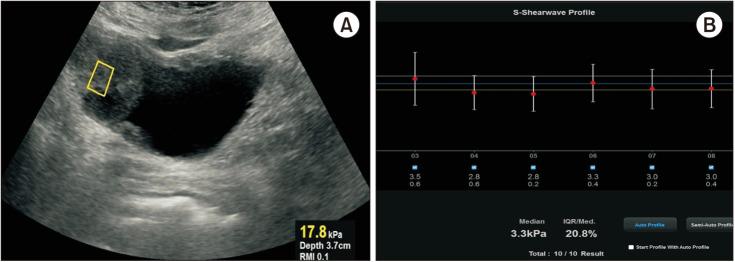 https://cdn.ncbi.nlm.nih.gov/pmc/blobs/c941/12058542/39dd76bb46da/icu-66-207-g001.jpg