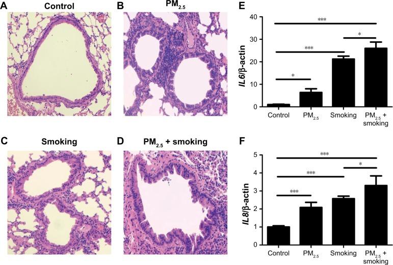 https://cdn.ncbi.nlm.nih.gov/pmc/blobs/c951/6512785/0673ffc81e23/copd-14-979Fig1.jpg